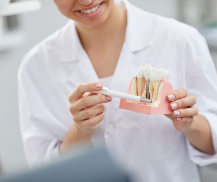 dentist-explaining-tooth-implantation-process-W4PZYA8.jpg
